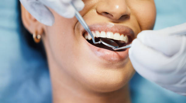 Best Walk-In Emergency Dentist in Niles, MI