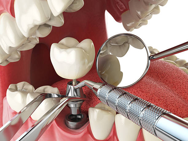 Professional Emergency Dentist in MI